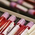  ������ ����������� ������� ��� ��������� ������ ��������� ���������� 