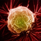 "Virtual tumour" is the new way to see cancer