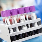  ������ ����� �������� ������ covid-19 ������ �������� 