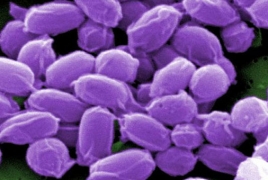 U.S. military accidentally sends live anthrax samples to labs