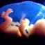 Նախագիծ. Հղիության արհեստական ընդհատման օրենքը խախտելու համար բժիշկները պատասխանատվության կենթարկվեն