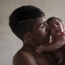 Zika linked to more birth defects besides microcephaly: WHO