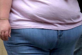 Obesity damages health and economy