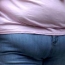 Obesity damages health and economy