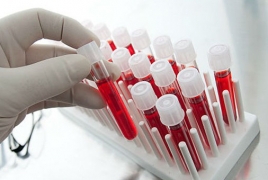 Արյան հետազոտությունը թույլ կտա հայտնաբերել քաղցկեղն ախտանիշների ի հայտ գալուց 10 տարի առաջ