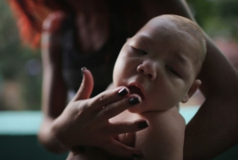Zika therapy “works in the womb,” scientists say