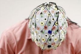 Brain stimulation to boost U.S. servicemen performance: scientists