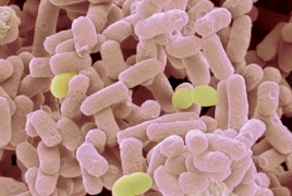 Scientists find bacteria resistant to last-ditch drug treatments