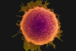 Nano-sized discs teach your body to kill cancer cells