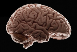 Human brain reshapes itself during spaceflight, study suggests