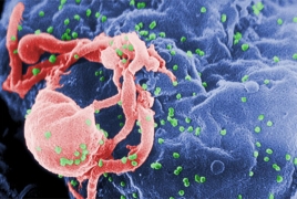 HIV vaccine therapy allows 5 people to control virus without drugs