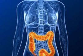 Colon cancer on the rise among younger adults