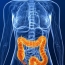 Colon cancer on the rise among younger adults