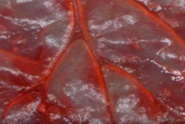 Scientists turn spinach into a farm for human heart cells