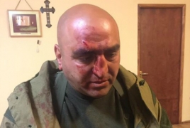 Армянская полиция  задержала  напавшего на оппозиционный блок «ЕЛК»