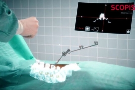 Microsoft HoloLens becomes an AR assistant for open spine surgery