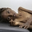 Yemen cholera outbreak kills 34, may spiral out of control: WHO