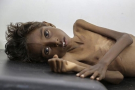 Yemen facing “total collapse” as fighting continues: UN