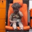 Мальчик из Алеппо: Год спустя родители показали ребенка - символа жестокости сирийской войны