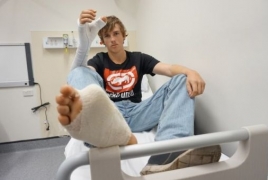 В Австралии 20-летнему парню пересадили большой палец с ноги на руку
