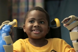 World's first child double hand transplant a 'success'