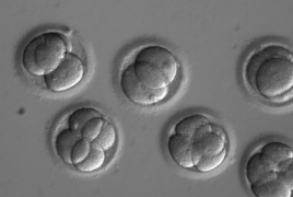 Scientists edit human embryo to erase heritable heart condition
