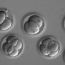 Scientists edit human embryo to erase heritable heart condition