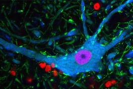 Scientists can now turn human skin cells into motor neurons
