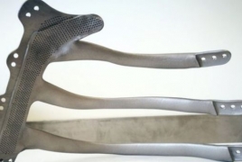 Բրիտանացի բժիշկները վերականգնել են հիվանդի կրծքավանդակը 3D տպիչի օգնությամբ