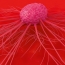 Lung cancer drug could kill off lobular breast tumors