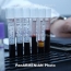 Scientists claim to have developed blood test to predict when you'll die