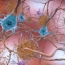 New drug trial could boost Alzheimer's research