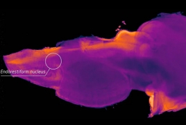 Newly discovered part of brain could be part of what makes you unique