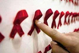 There are more important causes of disease than HIV in people with HIV