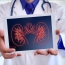 People with kidney failure face higher risk of cancer death