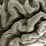Depression may speed brain aging: research
