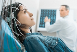 Electrical brain stimulation 