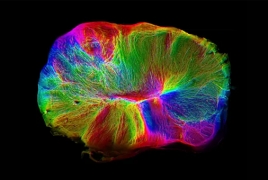 Scientists grow miniature brain that can contract muscle