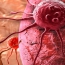 Stem cell treatment of cancer enters clinical trial in U.S.