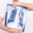 Antioxidant role in spread of lung cancer revealed in new studies