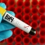 Գիտնականները ՄԻԱՎ-ի նոր շտամ են հայտնաբերել