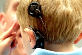 Правительство РА будет финансировать обслуживание слухового импланта и речевого процессора