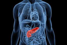 New treatment triggers self-destruction of pancreatic cancer cells