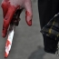 Գյումրիում 4 երիտասարդ է դանակահարվել. 2 եղբայրներից մեկն անչափահաս է