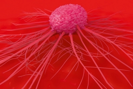 New method to detect early-stage cancer identified