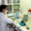 В Армении начнут производить по 1000-2000 тестов на коронавирус в день