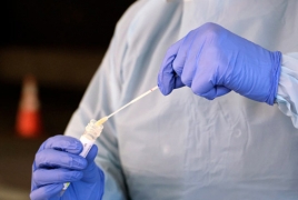 Японский новый тест на коронавирус показывает результат за 30 минут