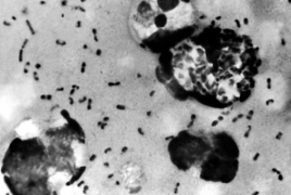 В Китае выявлен первый случай бубонной чумы