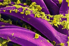 В Калифорнии мужчина заболел чумой: Это первый случай за 5 лет