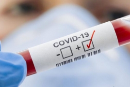 Covid-19: Armenia infections grew by 194 in the past 24 hours